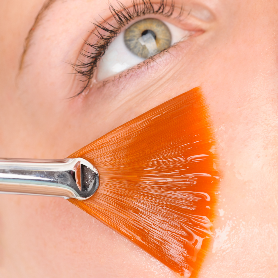 Peeling químico en ojeras