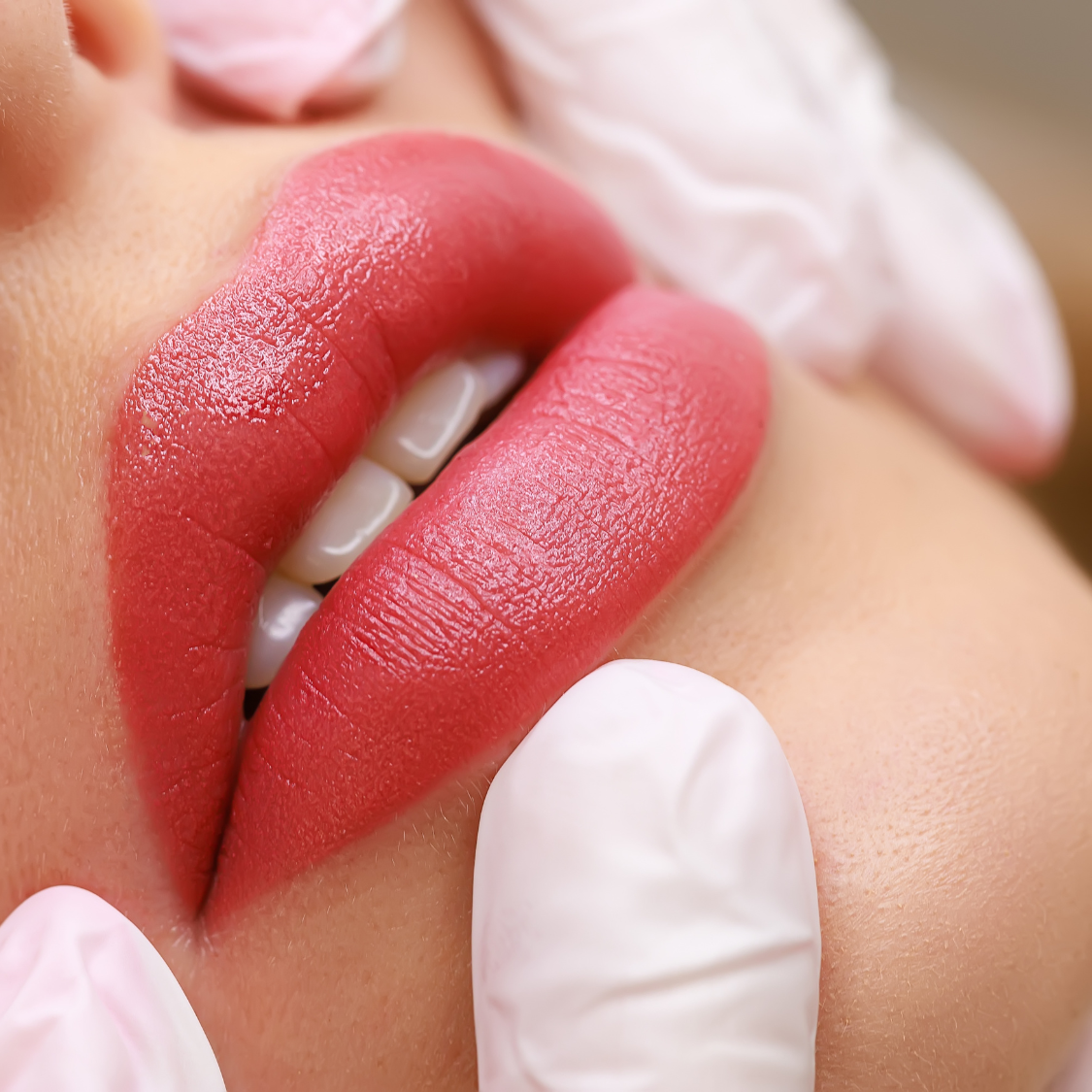 Perfilamiento y voluminización de labios