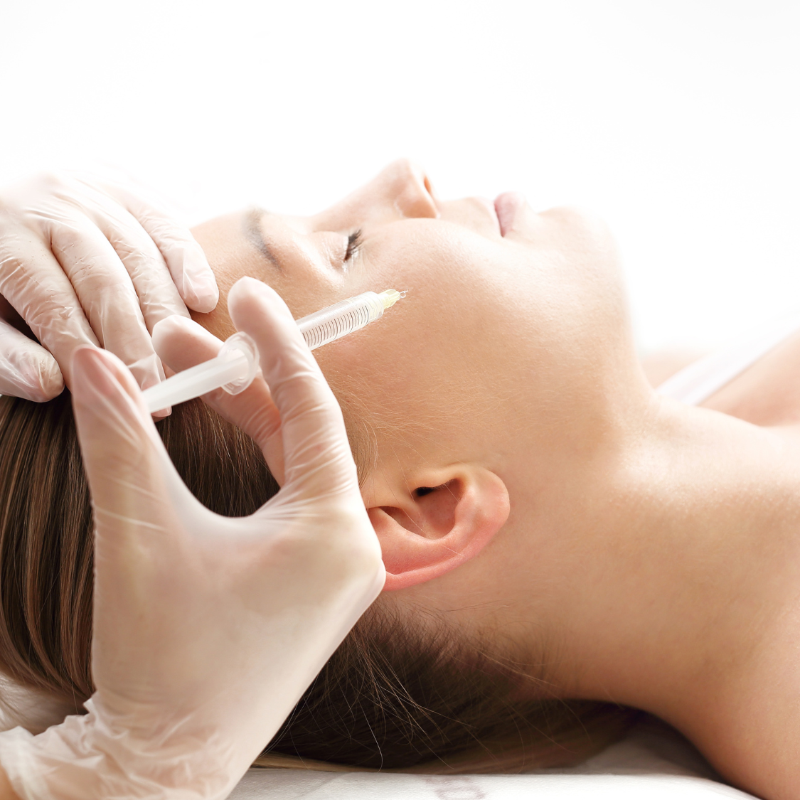 Mesoterapia facial