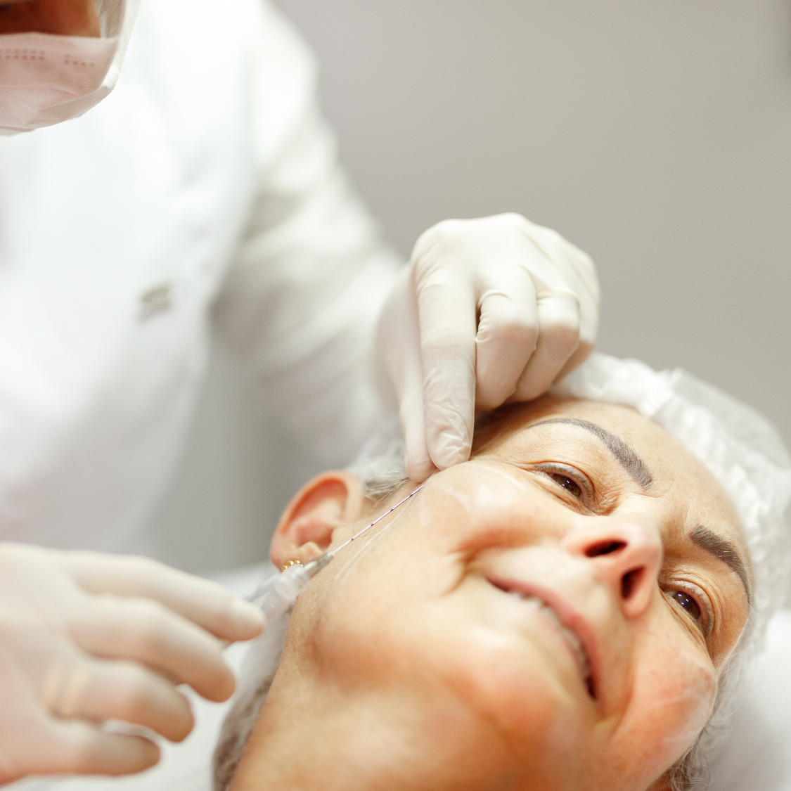 Bioestimulación con plasma rico en plaquetas